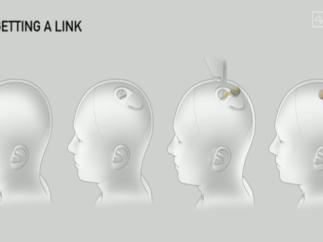 neuralink宣布将进行首次人体试验，对瘫痪患者的大脑植入设备